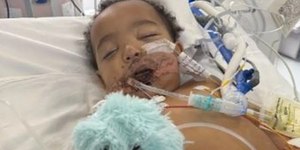 Bebê perde a língua após confundir mamadeira com soda cáustica