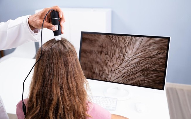 Tratamentos capilares ganham novas tecnologias