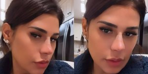 Simone Mendes nega cirurgia ao aparecer com nariz diferente