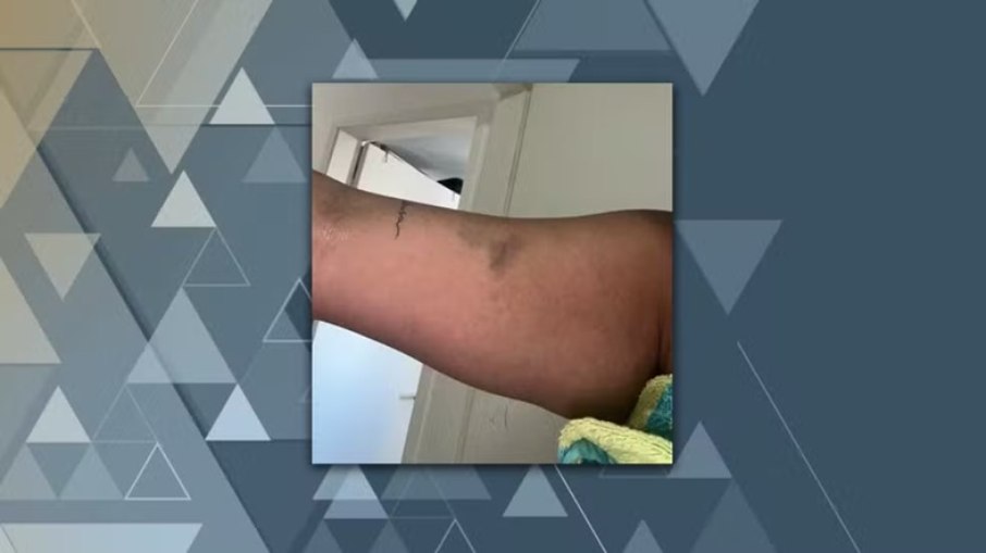 Gabriela, manteve um relacionamento de três anos com Cartolouco, afirma ter sido vítima de agressões ao longo relacionamento Gabriela, manteve um relacionamento de três anos com Cartolouco, afirma ter sido vítima de agressões ao longo relacionamento