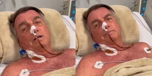 Como é a reconstrução do trânsito intestinal feita por Bolsonaro