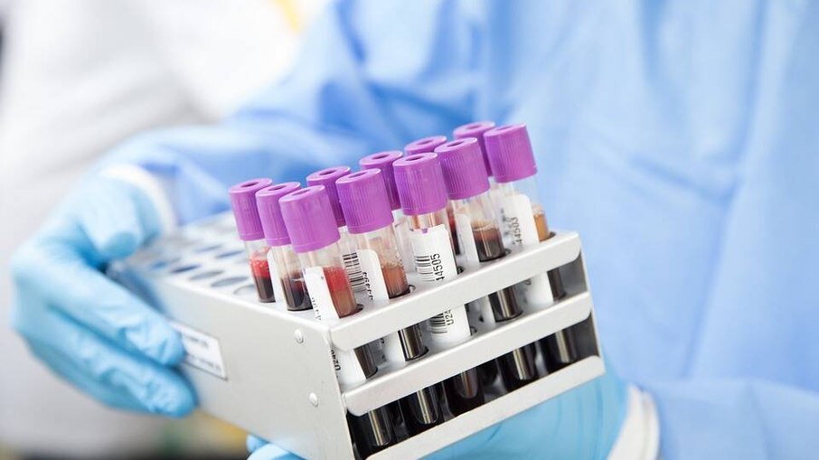 Primeiro teste de sangue para detectar covid longa é aprovado