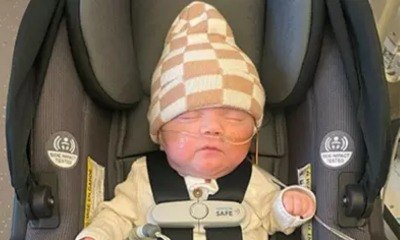 Nascido com 280g, bebê mais prematuro do mundo celebra 1 ano