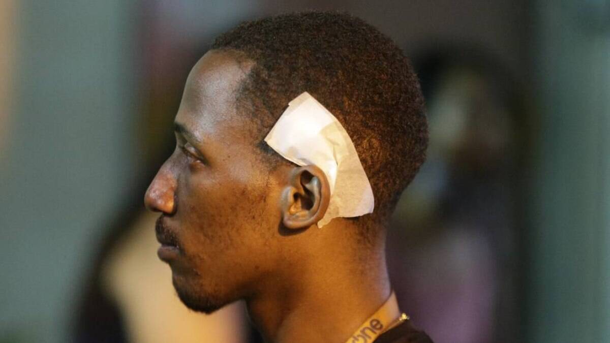 'Nasci de novo, graças a Deus', diz jovem baleado em tiroteio no RJ