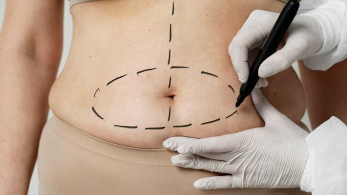 Saiba como a Cirurgia Plástica Funcional otimiza os resultados do procedimento cirúrgico 