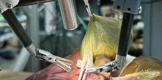 Robô realiza primeira cirurgia realista sem auxílio humano