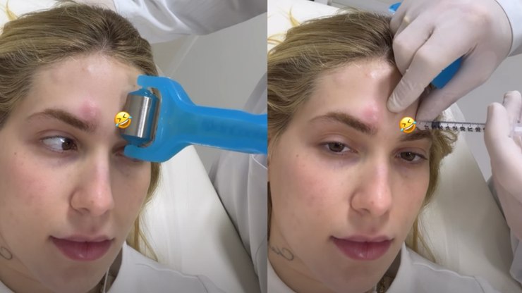Virginia desabafa após passar por tratamento médico: "Horrível"