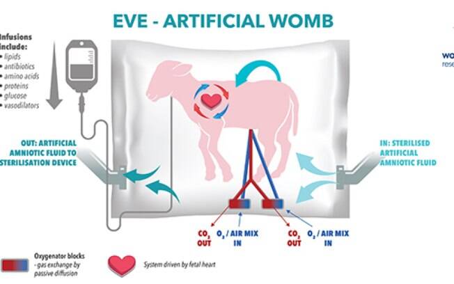 Incubação de  cordeiros em útero artificial evidencia avanço em tecnologias que podem salvar bebês prematuros