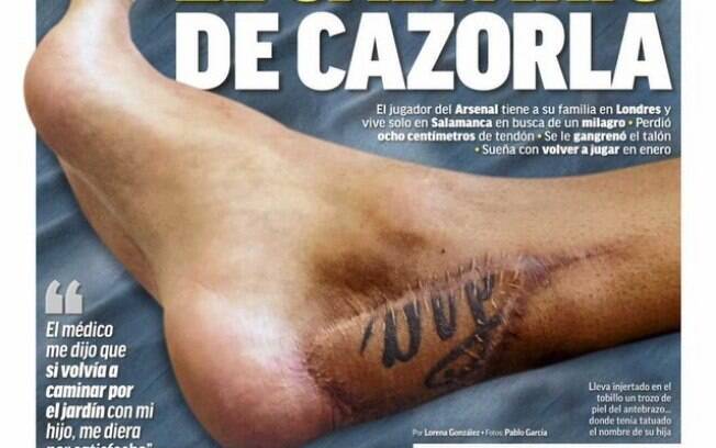 Capa do jornal Marca mostra o calcanhar de Santi Cazorla
