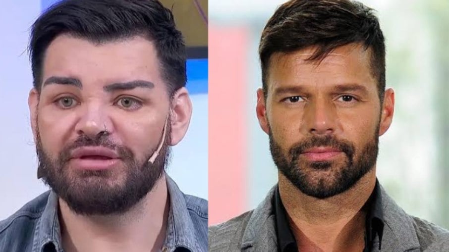 Homem faz mais de 30 cirurgias para se parecer com Ricky Martin