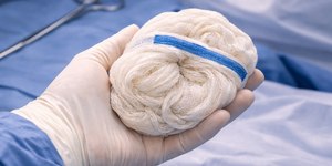 Compressa esquecida em cesariana gera indenização de R$ 40 mil