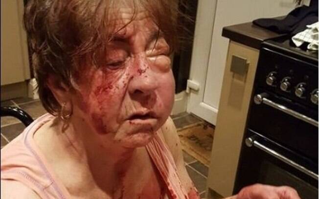 A idosa britânica Bárbara Dransfield sofreu golpes de tacos de beisebol na cabeça e no rosto