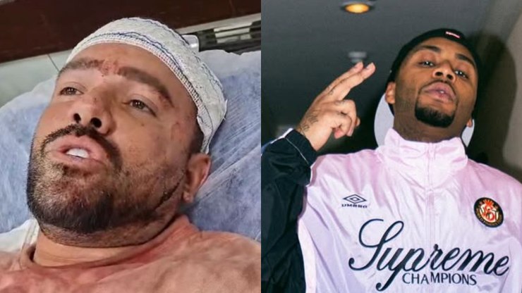 Vídeo: influenciador espancado por Orochi em show se pronuncia