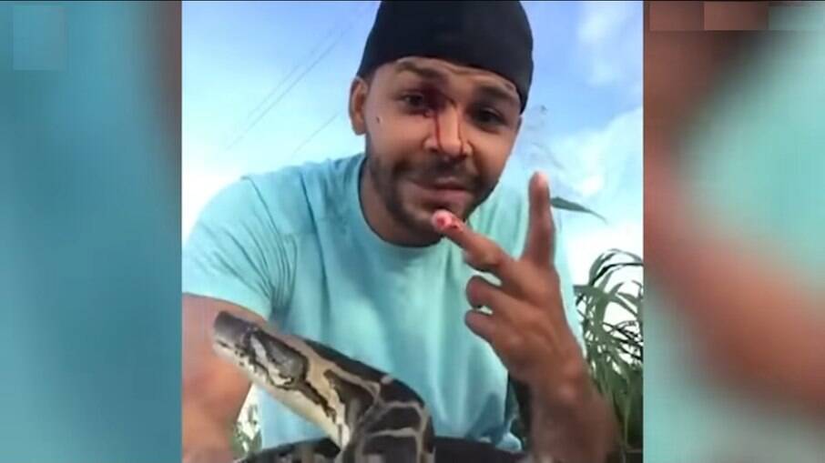  Nick Bishop é um tratador de cobras e quase teve seu olho arrancado após ataque de uma píton