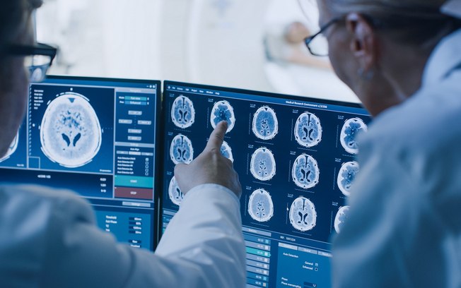 Nova técnica permite diagnosticar o Alzheimer com precisão
