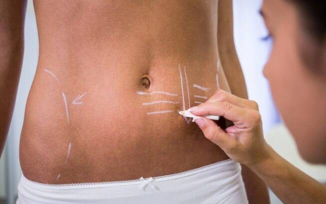 Lipoaspiração: busca pelo procedimento de alta definição aumenta na pandemia e atrai o interesse dos homens