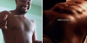 Davi Brito faz lipo HD e exibe transformação na web