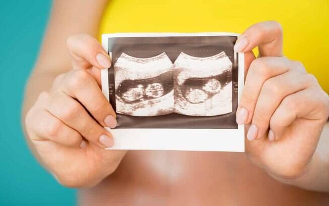 Médicos disseram ser possível que os gêmeos nos diferentes ventres possam ser idênticos