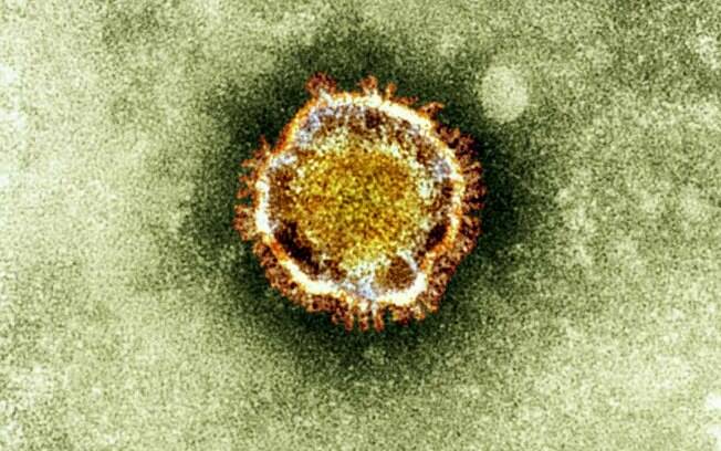 Casos confirmados de coronavírus chegam a mais 4 países