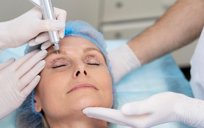 Rejuvenescimento facial alia diferentes técnicas