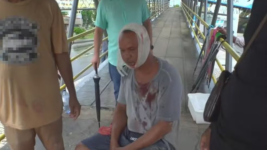 Homem fica ferido em incidente em Salvador