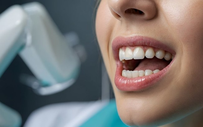 Clareamento dental com PAP reduz a sensibilidade e irritação