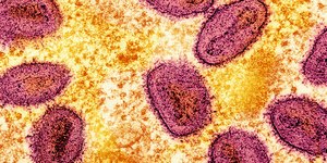 Brasil registra 149 casos de mpox em 13 estados
