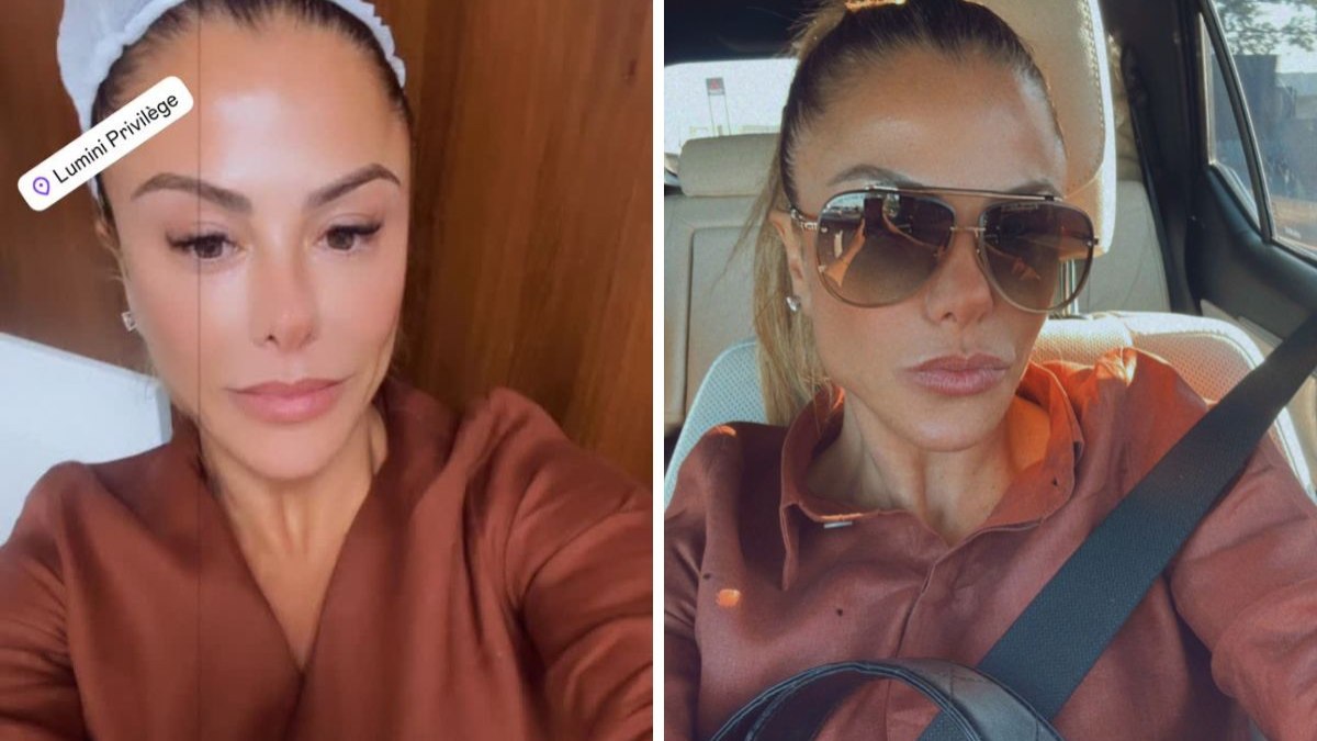 Poliana Rocha surge com olho inchado e tranquiliza seguidores