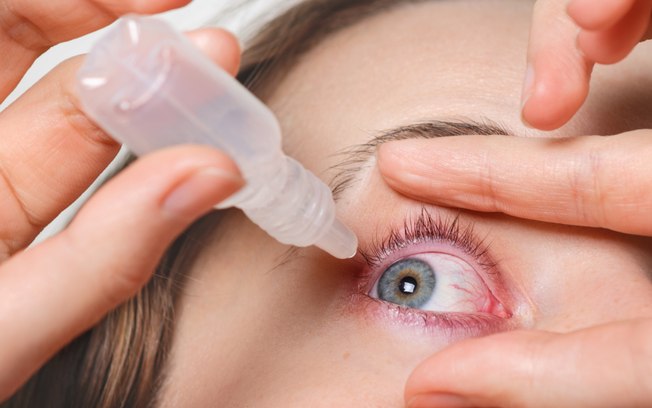 Tratamento da rosácea ocular avança com uso de tecnologia