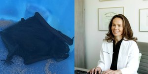 Médica sonha com rato e acorda com morcego na boca