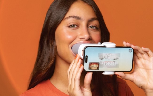 SouSmile lança monitoramento remoto com IA inédito no Brasil