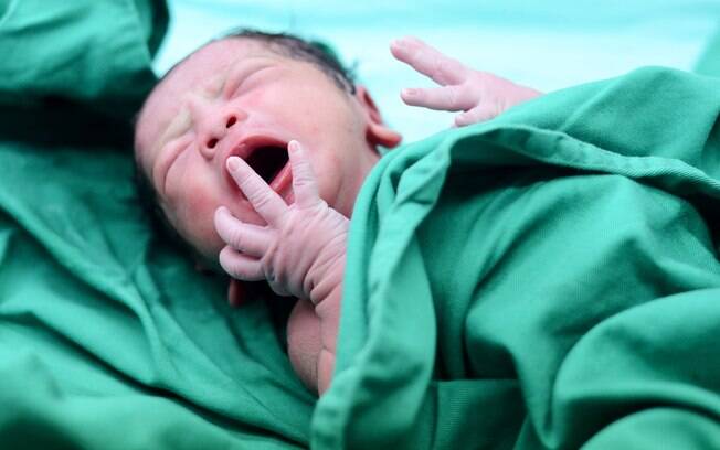 Em Campo Grande, bebê tem clavícula fissurada durante o parto