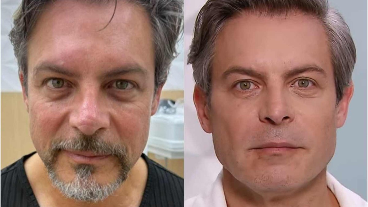 Antes e depois de Luigi Baricelli Antes e depois de Luigi Baricelli
