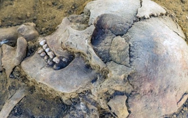 Esqueleto de egípcia que morreu há 3.300 anos trazia um tumor com dentes