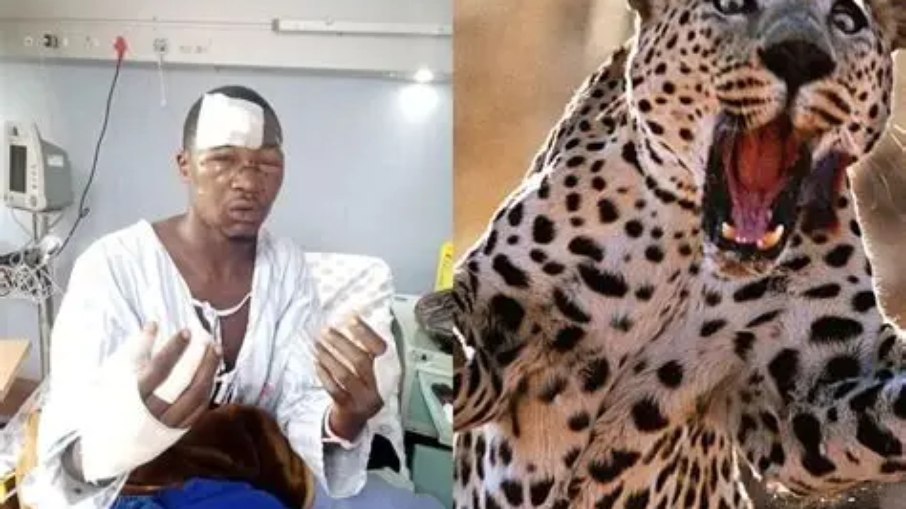 Ndumiso Mona não apenas sobreviveu a um ataque de leopardo: ele conseguiu enfrentar o animal em uma luta desesperada pela vida e resistir até ser socorrido.