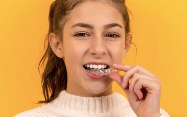 Alinhador invisível: como funciona o tratamento dentário