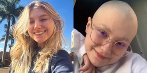 Isabel Veloso afirma que ficará careca de novo para tratar câncer