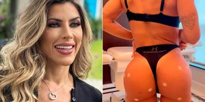 Ana Paula Minerato remove hidrogel do corpo após complicações
