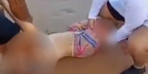 Jovem tem perna arrancada por tubarão em praia de Recife
