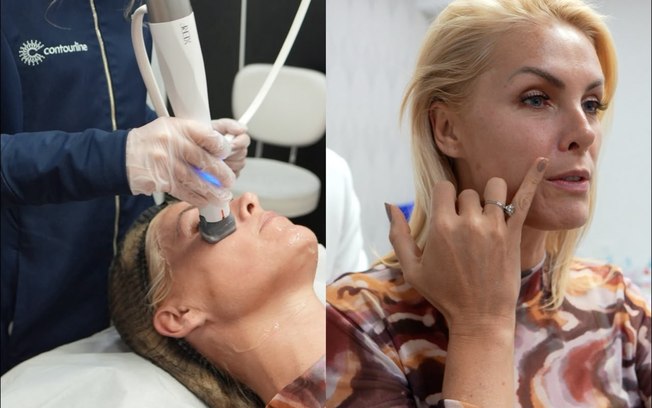 XERF conquista celebridades que buscam a renovação da beleza