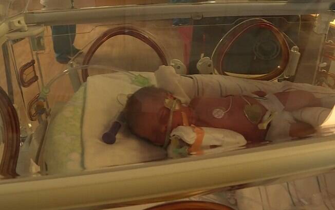 A pequena Letty Evans nasceu prematura, porém, tudo correu bem durante o parto e ela está saudável