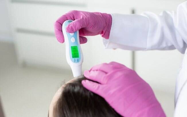 Casos de calvície feminina aumentarão em 30% no Brasil