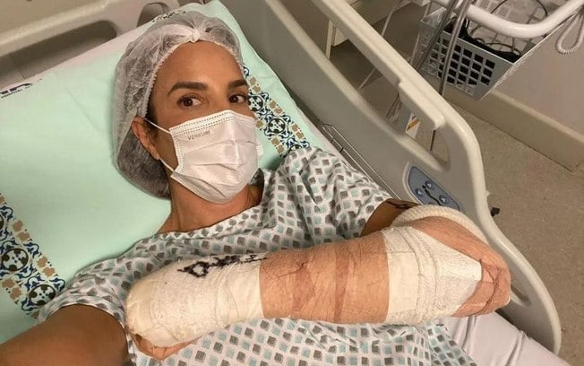 Ivete Sangalo aparece imobilizada e revela cirurgia