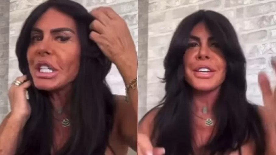 Gretchen mostra nova harmonização facial e exibe rosto sem filtro Gretchen mostra nova harmonização facial e exibe rosto sem filtro