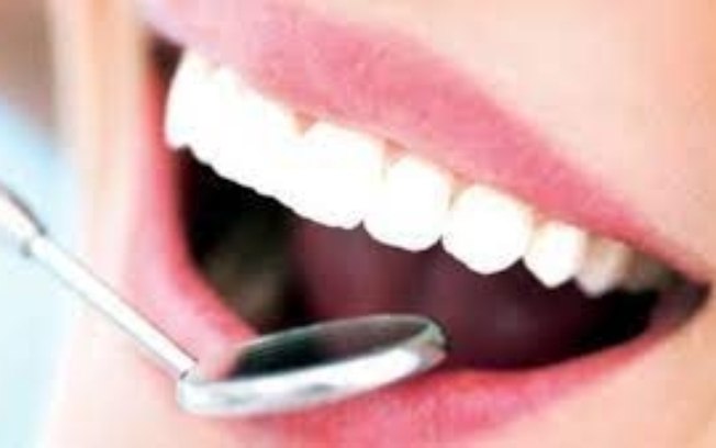 Doenças periodontais geram consequências graves para saúde