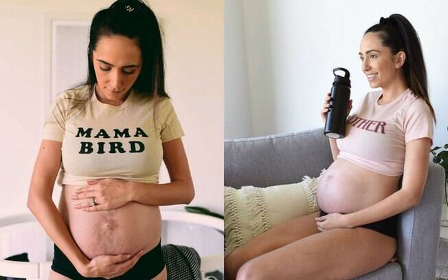 Brittany Noonan chegou a sofrer com os padrões de beleza na gravidez, mas entendeu que as marcas são apenas detalhes