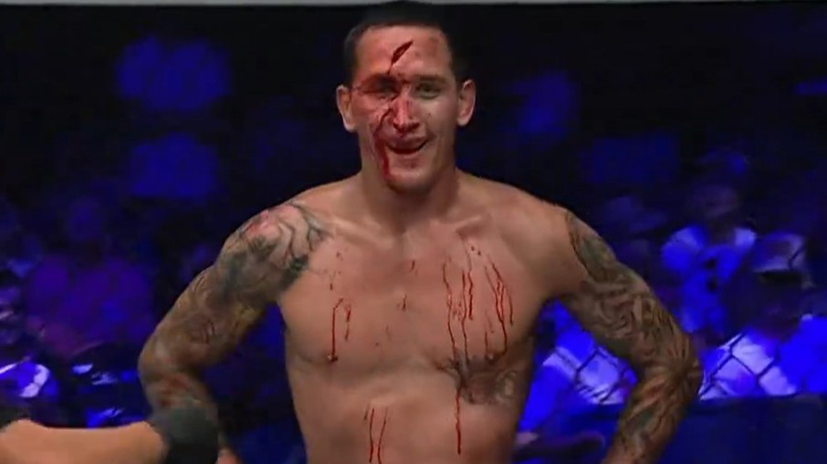 Lutador fica desfigurado após joelhada na testa em luta de MMA