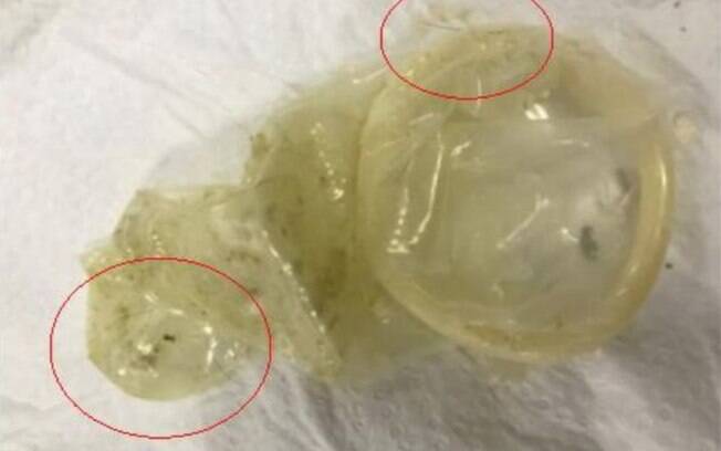 O preservativo, que foi encontrado apenas no dia seguinte pela consumidora, tinha alguns pelos
