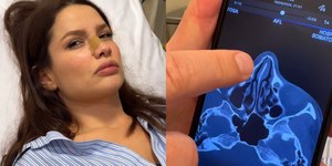 Juliette sofre acidente doméstico e fratura o nariz; vídeo