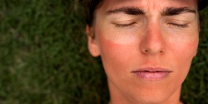 Insolação: veja como tratar o sintomas e diminuir o calor